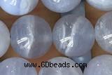 AGAT61 15 inches 10mm round blue lace agate beads