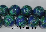 CTU1817 15.5 inches 16mm round synthetic turquoise beads